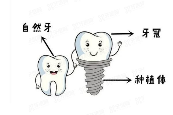 郴州口腔医院种植牙价格表www.yadoo.cn