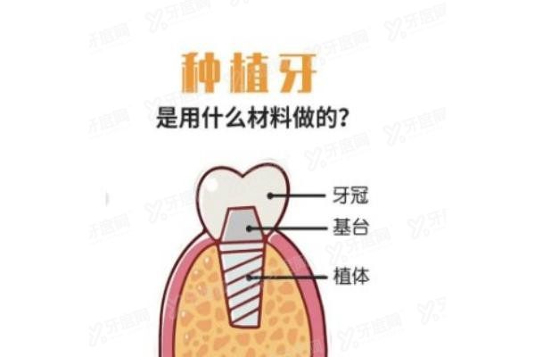 西藏口腔医院种植牙价格表www.yadoo.cn20241011432680.jpg