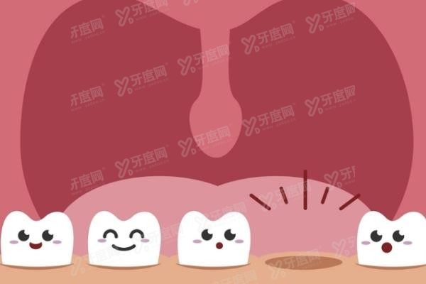 新余口腔医院种植牙价格表www.yadoo.cn