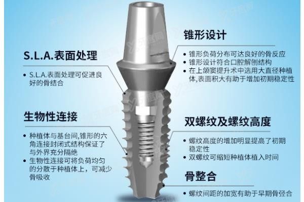 韩国登腾种植牙质量怎么样？www.yadoo.cn