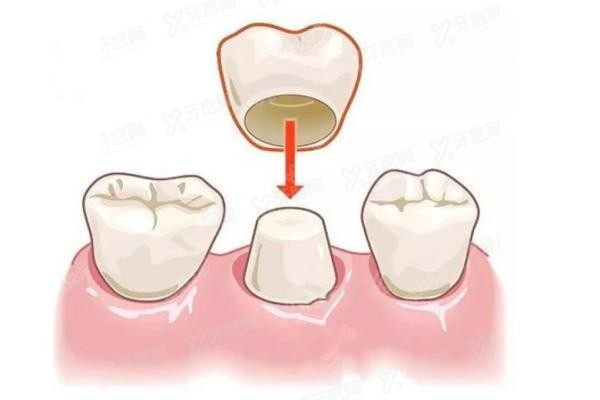 哈尔滨中航口腔医院价格查询www.yadoo.cn