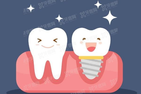 青岛市南区口腔医院种植牙价格表www.yadoo.cn