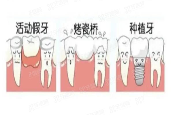 美冠塔口腔医院收费标准