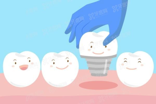 贵州安顺种植牙医院排名前十www.yadoo.cn