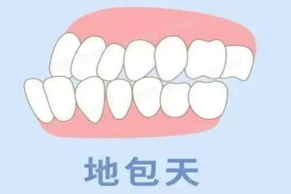 深圳地包天矫正医院哪家好www.yadoo.cn20241225825175.jpg 深圳地包天矫正医院哪家好www.yadoo.cn20241225825175.jpg