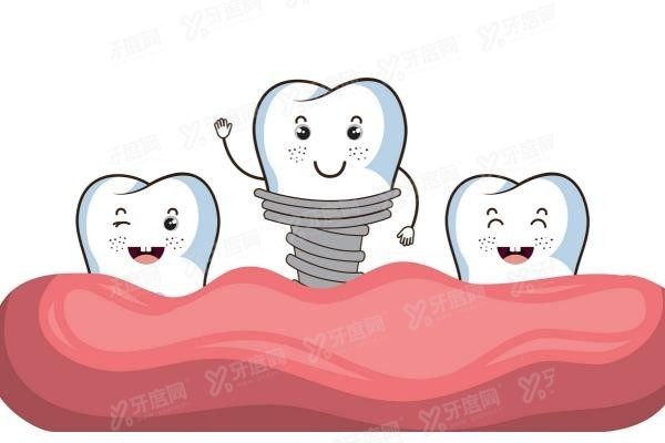 益阳种植牙口腔医院价格表www.yadoo.cn