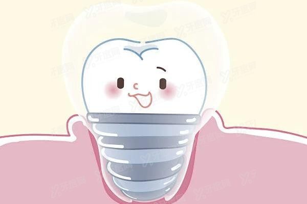 宜春口腔医院种植牙价格表www.yadoo.cn
