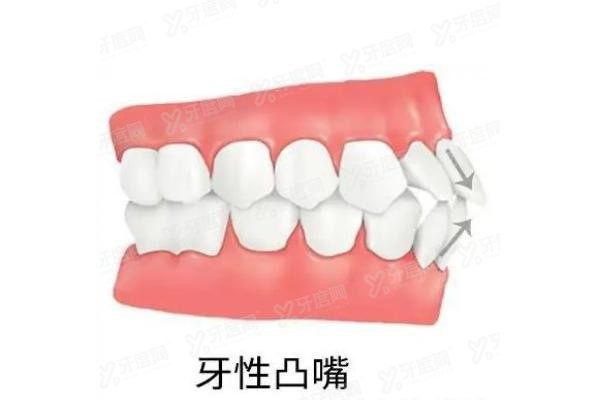 国内做突嘴手术医院排名前十www.yadoo.cn20250211228966.jpg