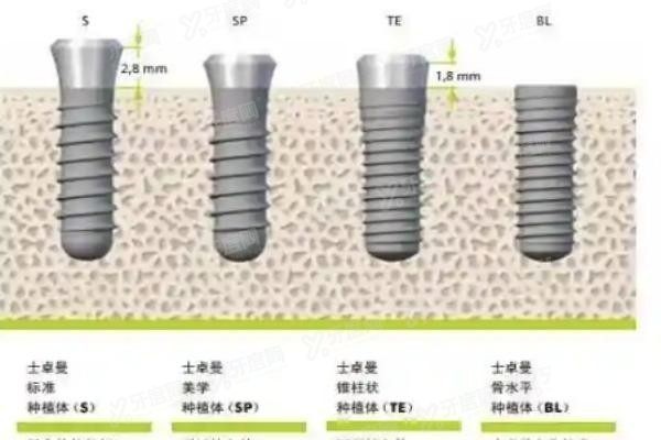 瑞士iti士卓曼种植体材质价格
