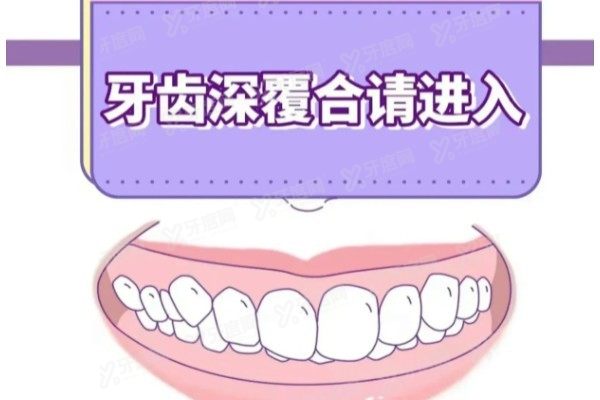 深覆合牙齿矫正费用大概多少钱www.yadoo.cn