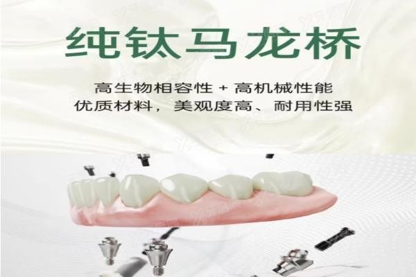 种植牙马龙桥收费价格表