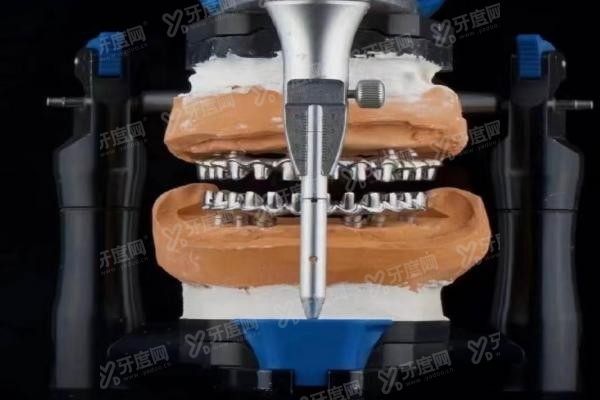 种植牙马龙桥什么概念www.yadoo.cn