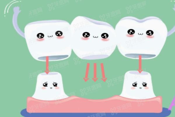 医生不建议做吸附式假牙怎么办