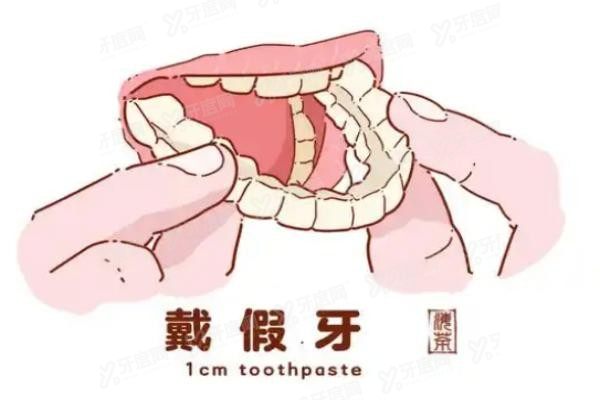 为何有时医生不建议做吸附式假牙www.yadoo.cn