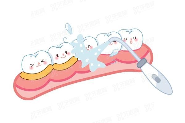 牙齿修复液的优势有哪些www.yadoo.cn20250310272207.jpg