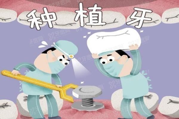江阴种植牙医生推荐：黄成勤与卢振辉的微创种植牙技术深受好评