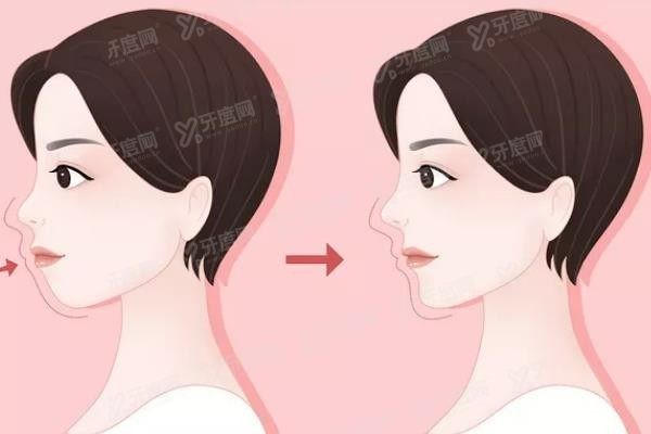 重庆松山医院正颌手术有失败<span style=