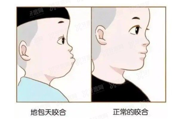 国内十大地包天矫正医院排行榜www.yadoo.cn