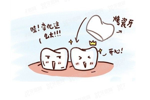 二氧化锆全瓷牙品牌排行榜www.yadoo.cn