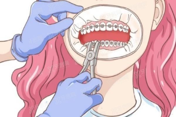 张家口麦格口腔医院矫正牙齿多少钱
