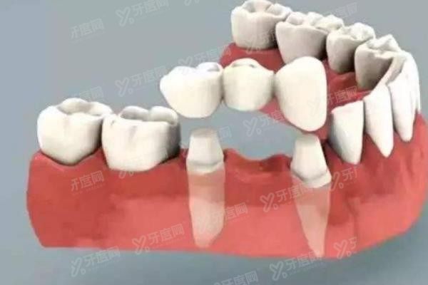 13e29f8243ba0e0b2b15c03947fda706(1).jpg