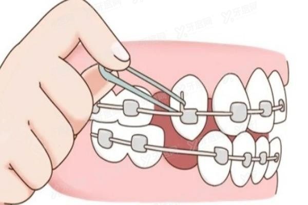 张家口麦格口腔医院矫正牙齿怎么样