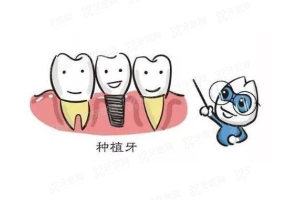 科威尔种植牙质量如何www.yadoo.cn