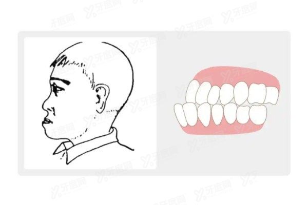 重庆王涛正颌手术和肖林哪个好www.yadoo.cn