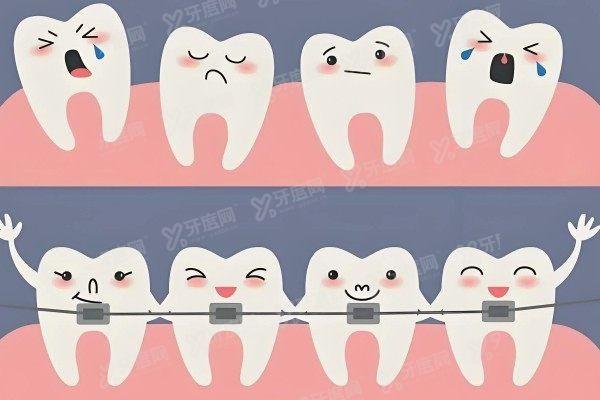 西宁口腔医院做牙齿矫正价格表www.yadoo.cn