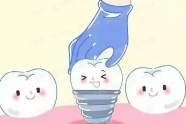 太原种植牙医院排名前十www.yadoo.cn