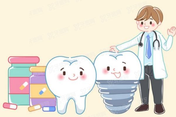 重庆云阳种植牙价格表www.yadoo.cn