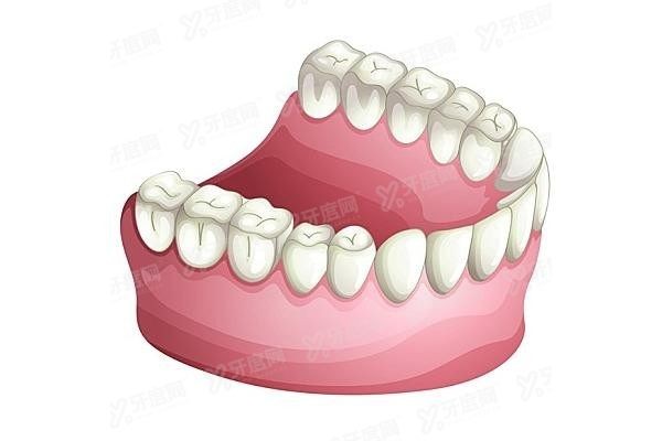 深圳全口假牙医院哪家好www.yadoo.cn20250521885797.jpg