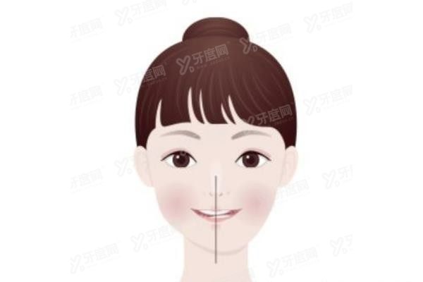 重庆王涛正颌手术费用是多少www.yadoo.cn