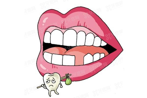 福州镶牙好又便宜的医院价格表www.yadoo.cn20250522345227.jpg
