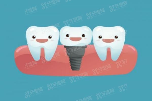 芜湖种植牙好的医院有哪些www.yadoo.cn20250522972309.jpg