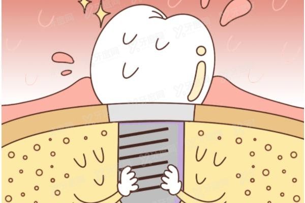 常德口腔医院种植牙价格表www.yadoo.cn