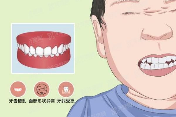 深圳正颌手术医院排名前五名www.yadoo.cn20250528795044.jpg