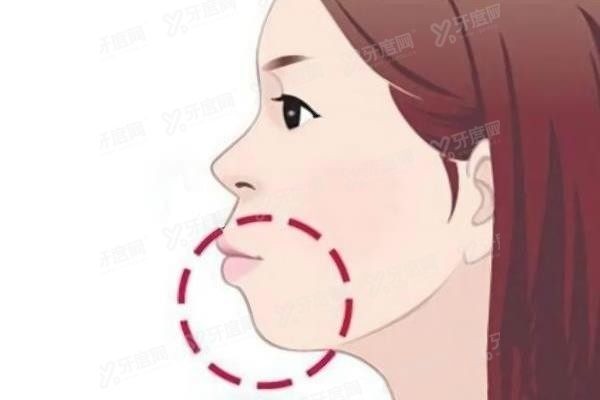 广州正颌手术可以医保报销吗www.yadoo.cn