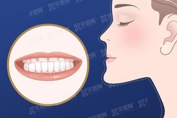 为什么医生不建议做正颌矫正手术www.yadoo.cn