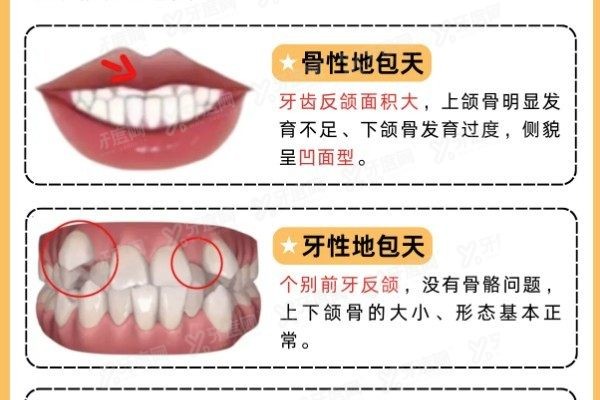 地包天牙性和骨性区别www.yadoo.cn