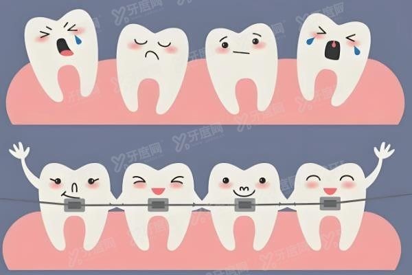 张栋梁医生正畸怎么样www.yadoo.cn