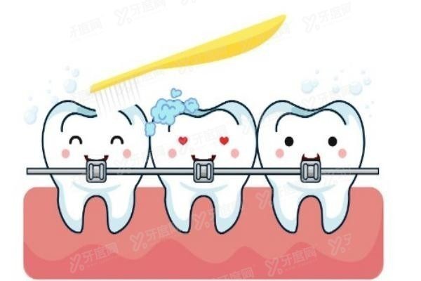 南京美奥口腔牙齿矫正费用明细