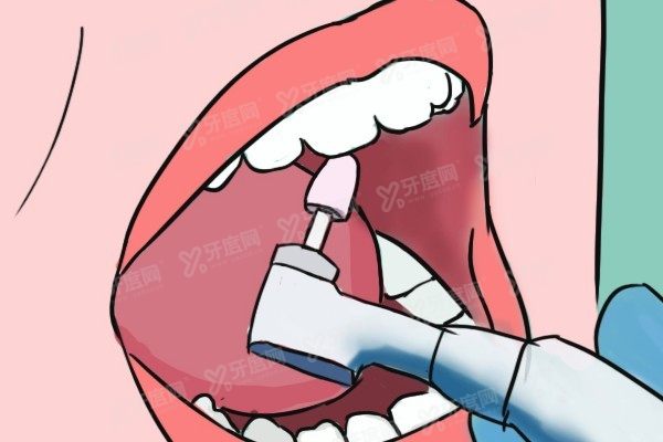 吉安口腔医院收费标准www.yadoo.cn