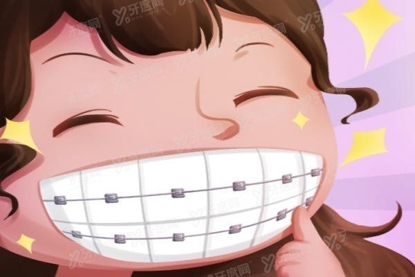金属矫正牙齿价格表