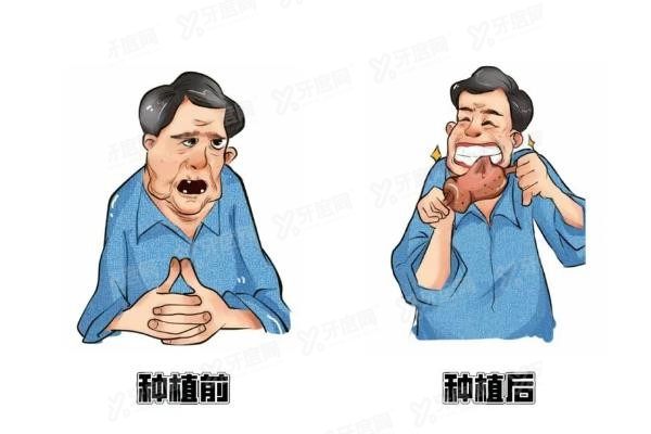种植牙1980元是真的吗