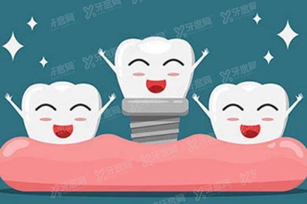 广州白云区种植牙价格表