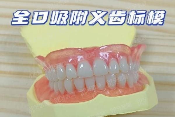 深圳全口吸附性义齿医院排名前五名