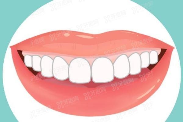 深圳牙齿美学贴面便宜又好的医院介绍