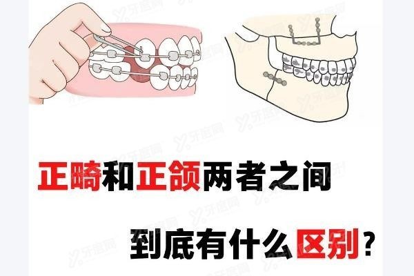 正颌是什么意思啊