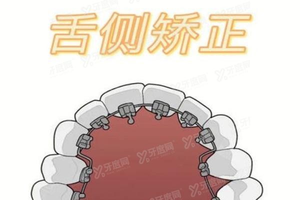 深圳舌侧矫正医生排名榜前十名